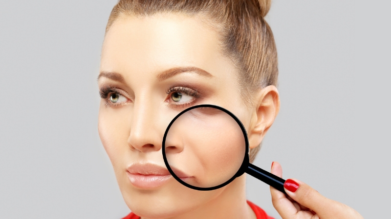 Žena sa lupom pokazuje nazolabijalne bore koje se protežu od nosa ka uglovima usana